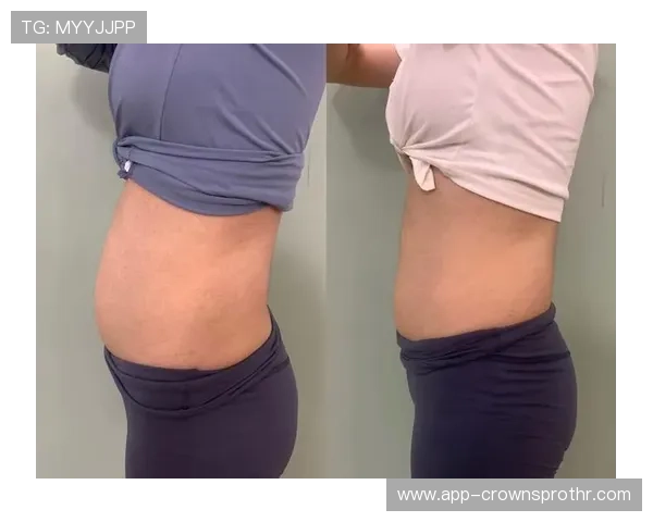 侯志慧这日常也太拼了，早上炉火纯青练瑜伽，晚上碳水狂欢炸肚皮！